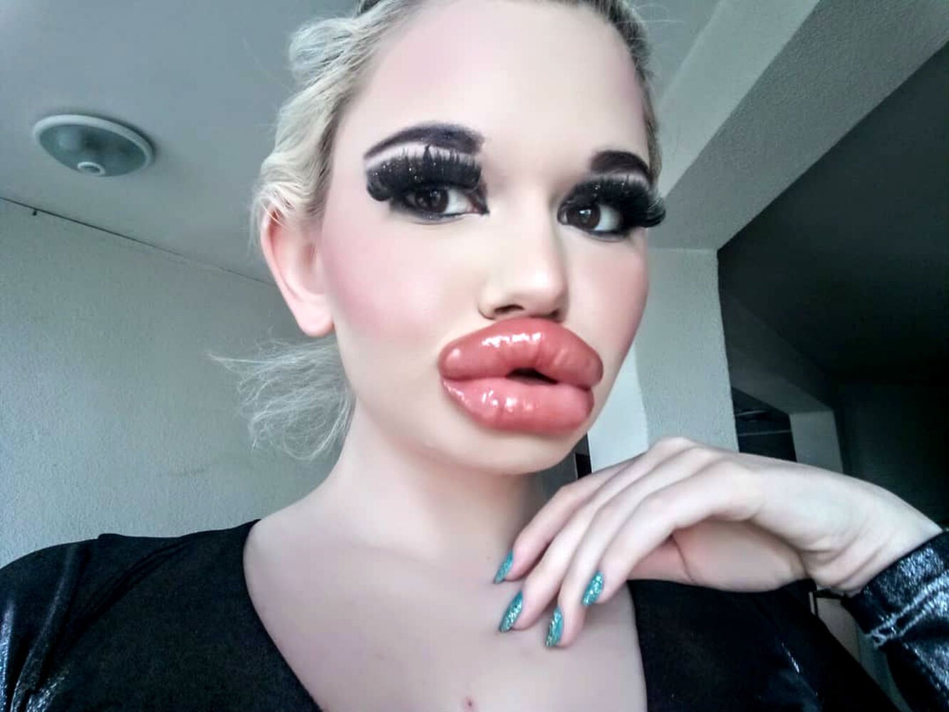 Фото девушка с накаченными губами